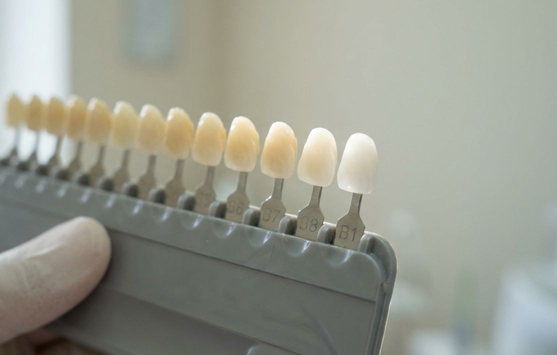 Teeth Whitening